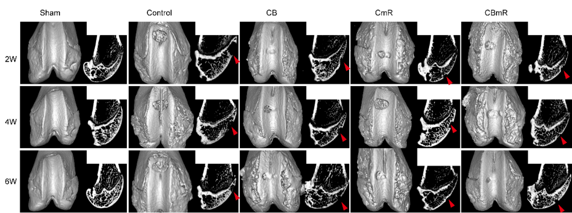 TGF-β3 cmRNA抑制软骨下骨的病理学变化。
